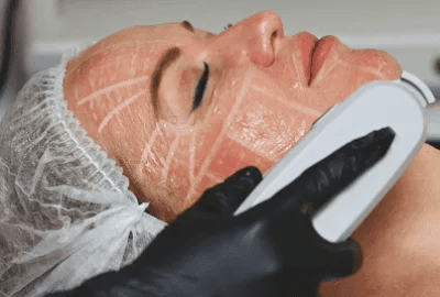 majestic-spa-face-036